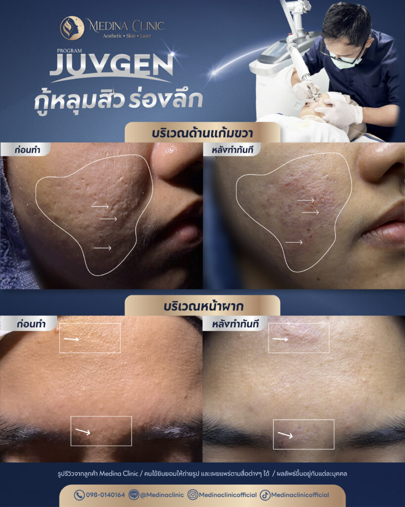 Juvgen-Review-23