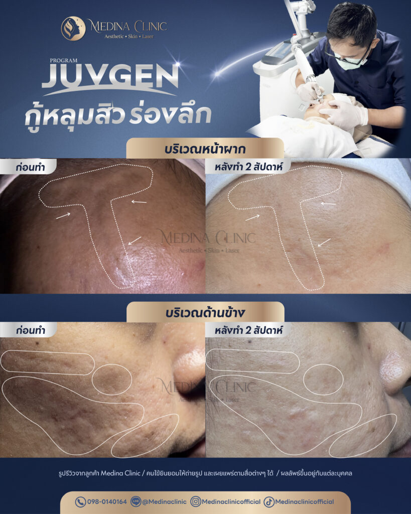 Juvgen-Review-24