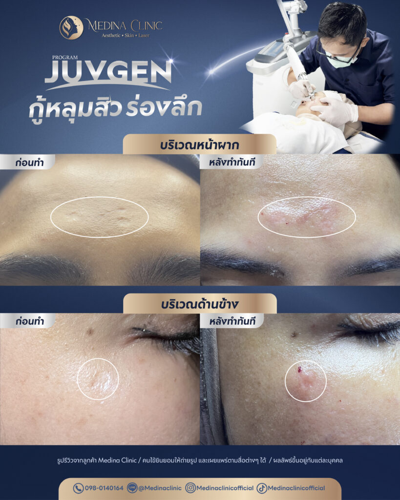 Juvgen-Review-25