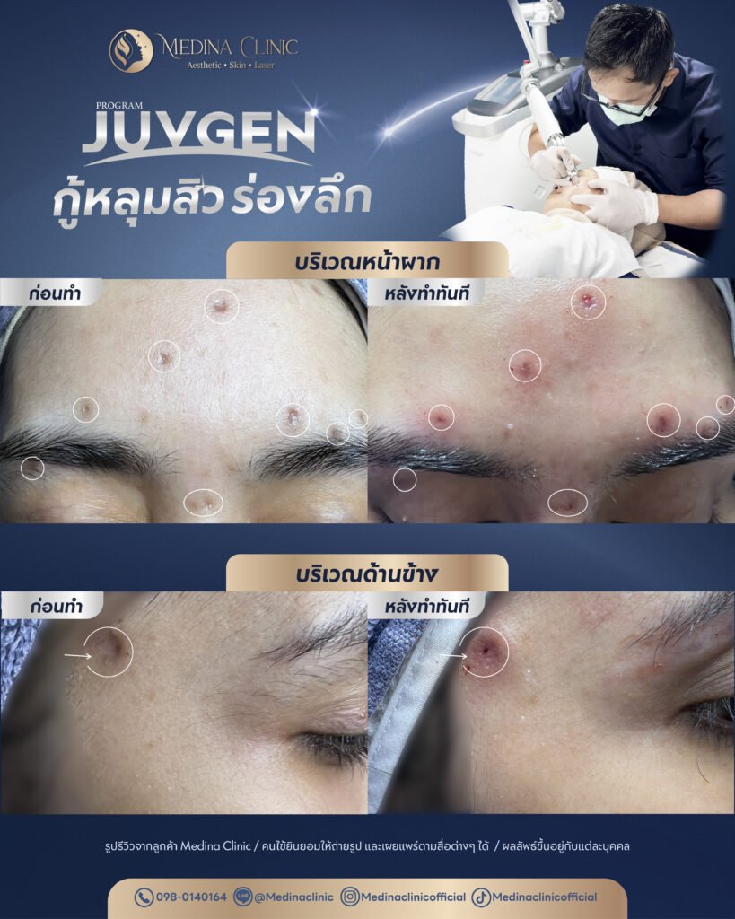 Juvgen-Review-26