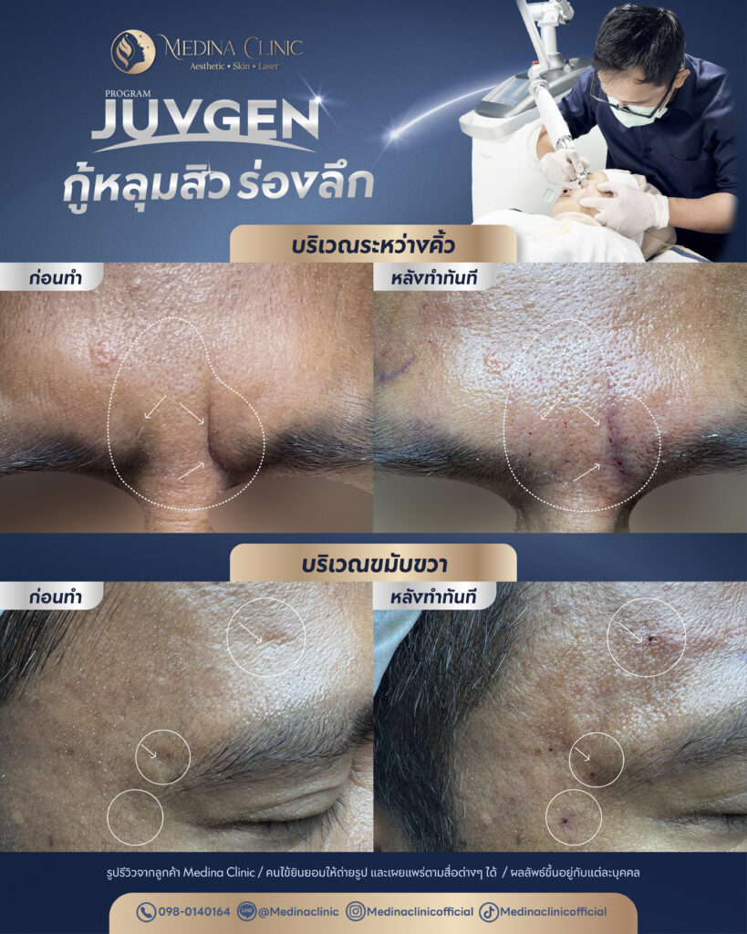 Juvgen-Review-27