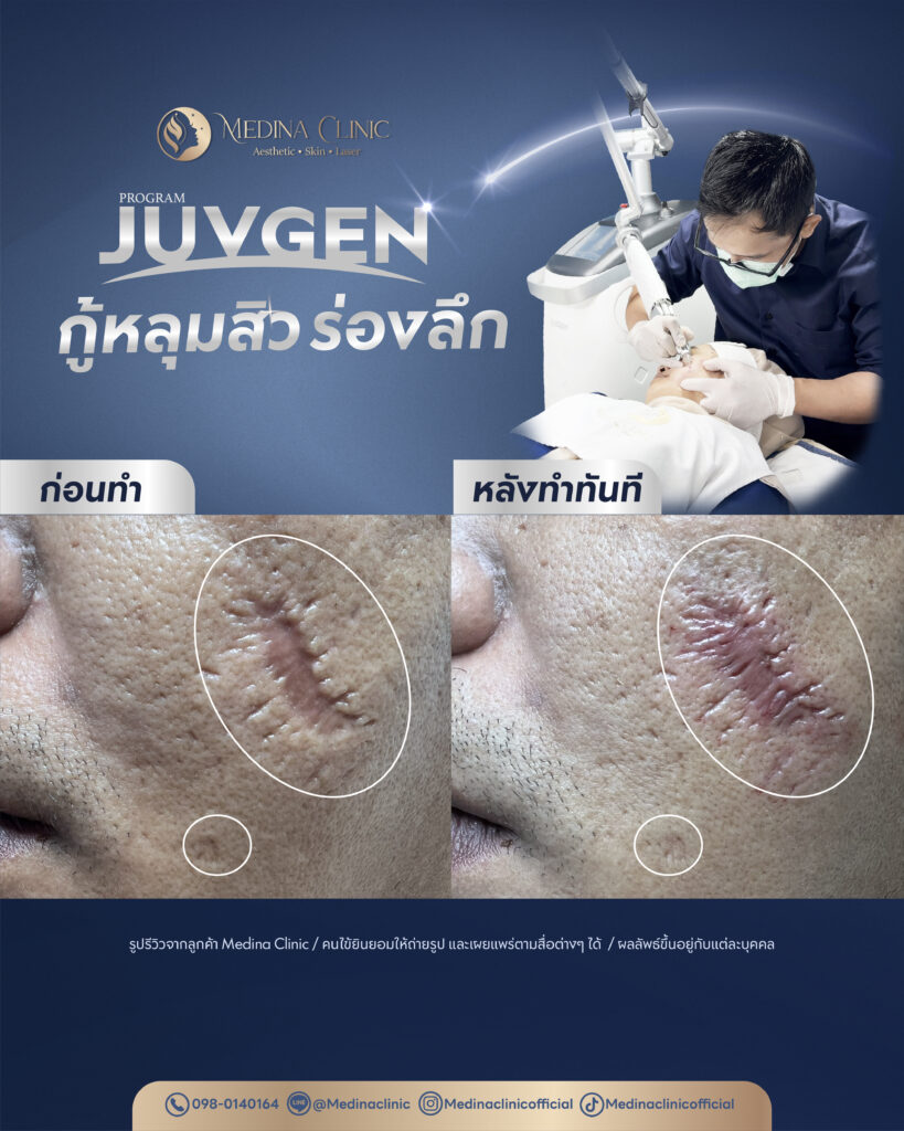 Juvgen-Review-28