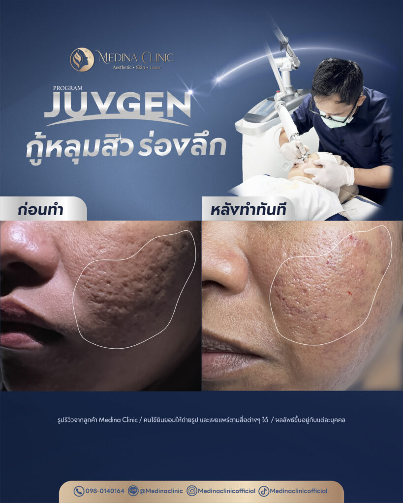 Juvgen-Review-29