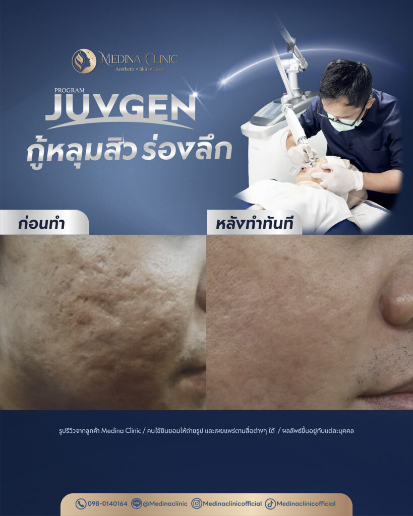 Juvgen-Review-30