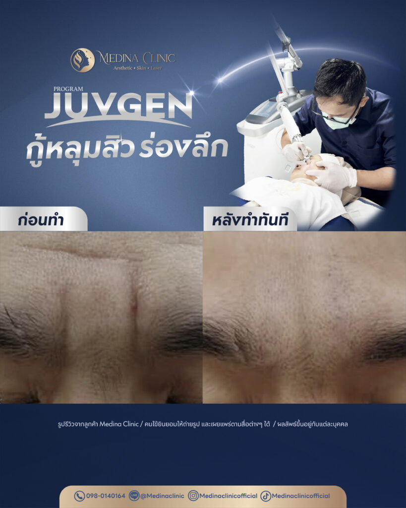 Juvgen-Review-31