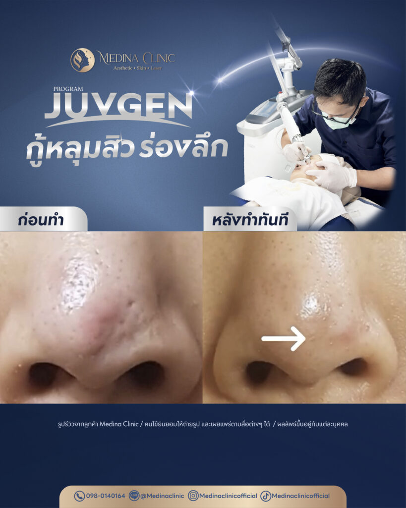 Juvgen-Review-32