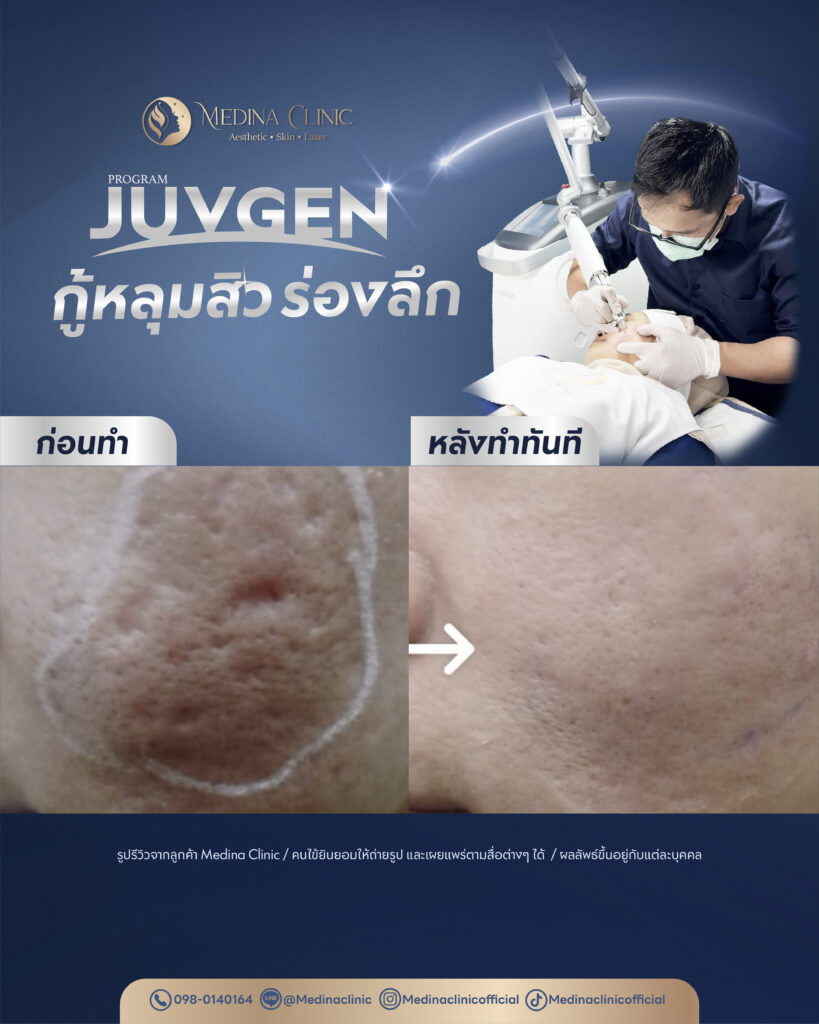 Juvgen-Review-33