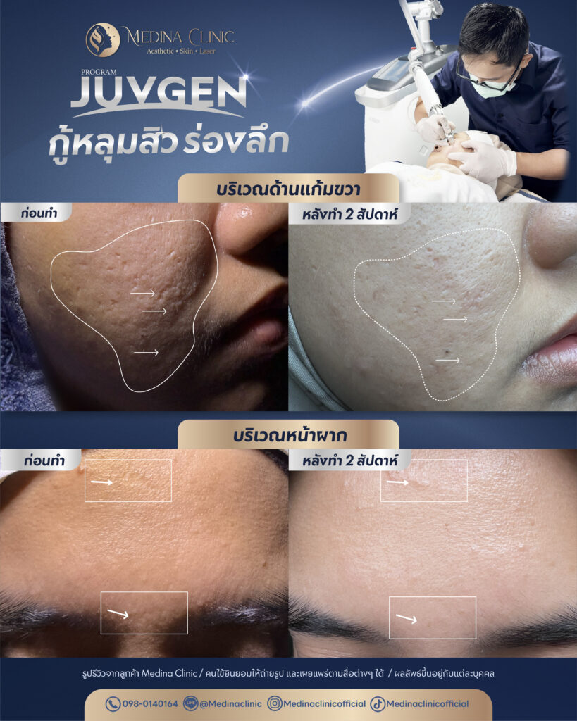 Juvgen-Review-34